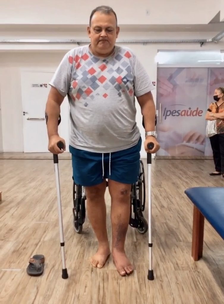 alex teles durante o período de tratamento no centro de reabilitação do ipesaúde foto francielle nonato agecom