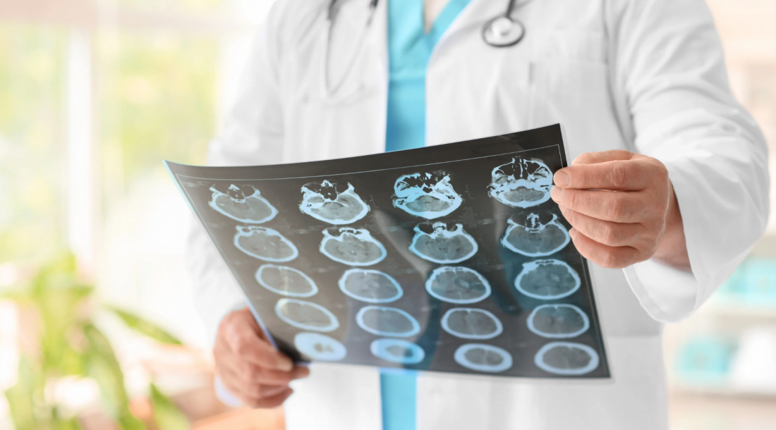 Maio Cinza busca conscientizar sobre sinais e tratamentos do câncer cerebral / Fotos: Ascom Ipesaúde