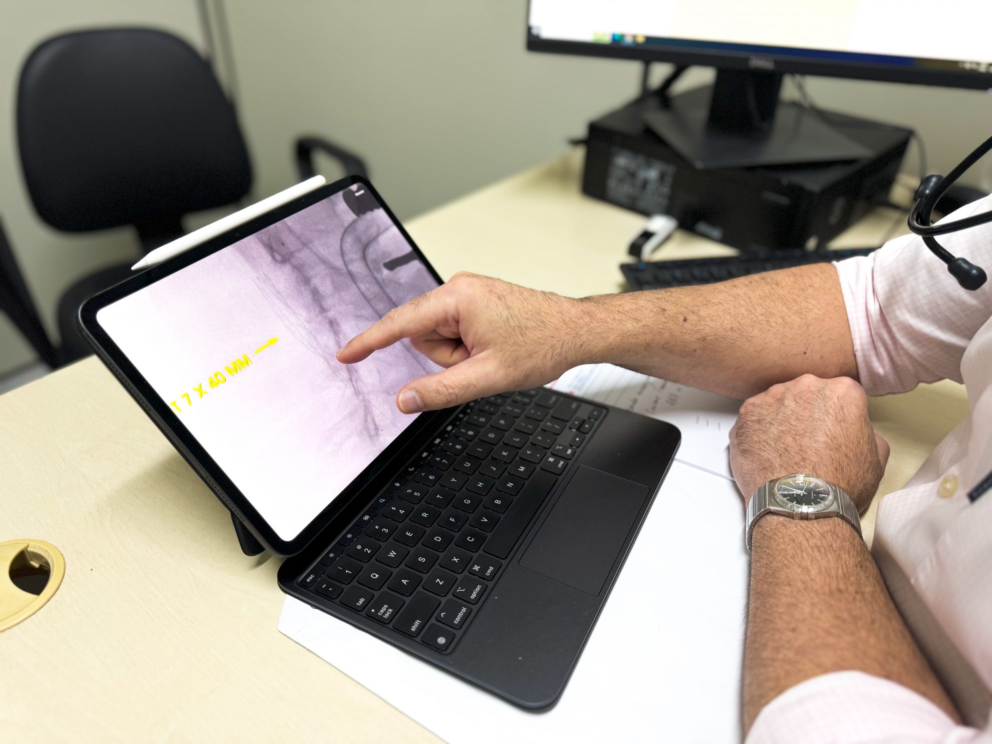 Serviço de Angiologia do Ipesaúde